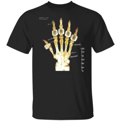 Kobe Hand X Ray Shirt